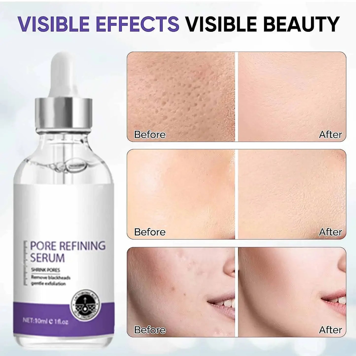 Pore Shrinking Serum Face Removing Large Pores